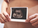 Zusatzpräparate in der Schwangerschaft?