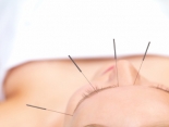Extra: Akupunktur gegen Morgenübelkeit