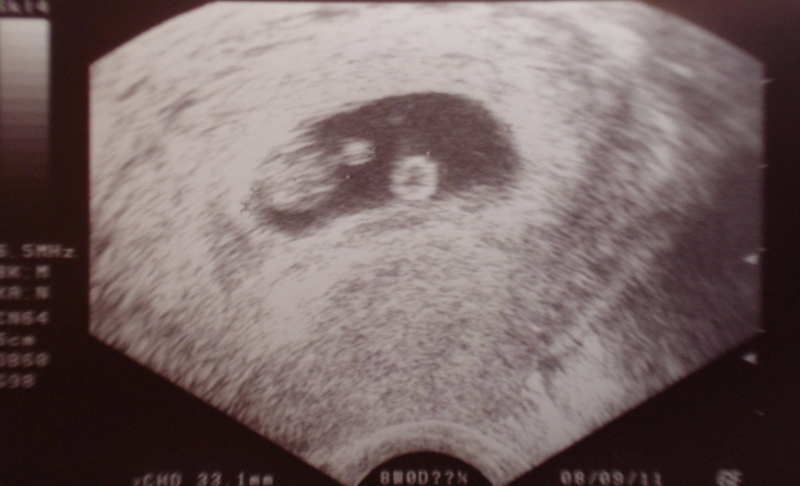 Monat schwanger 3 